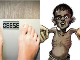 உடல்பருமன் ஏழை நாடுகளையும் விட்டுவைக்கவில்லை.
