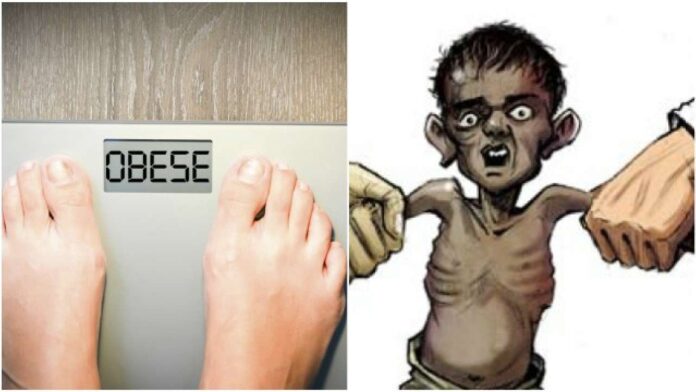 622266-obesity